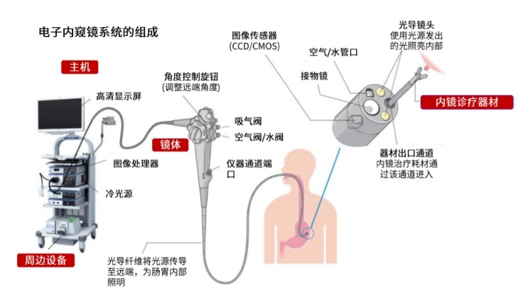 電子內(nèi)窺鏡系統(tǒng)的組成 電子內(nèi)窺鏡系統(tǒng)的組成