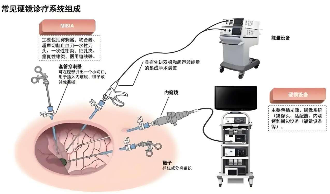 濾光片 常見硬鏡診療系統(tǒng)組成